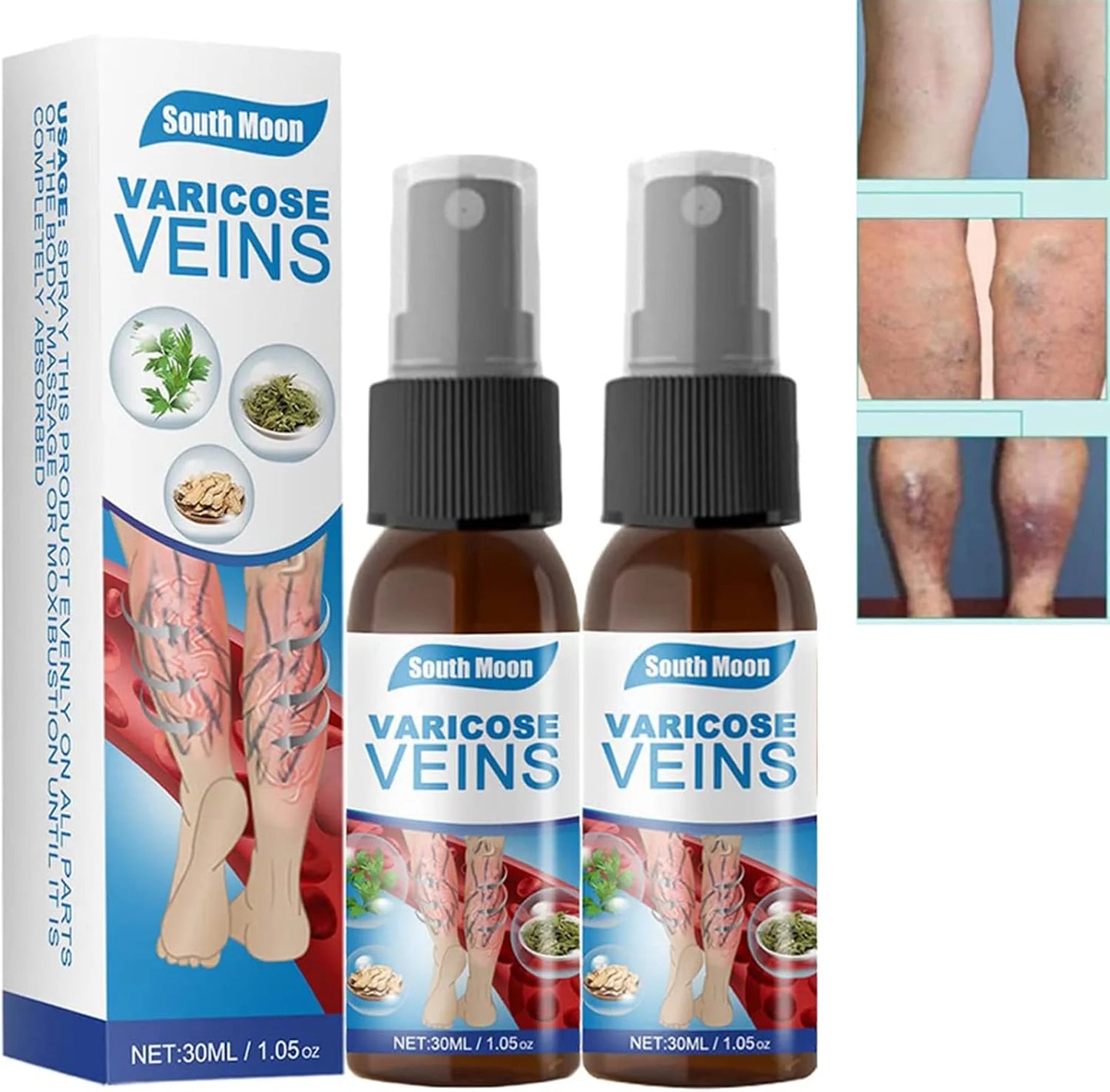 ✨ Spray Varicose Veins – Piernas ligeras y descansadas todos los días ✨